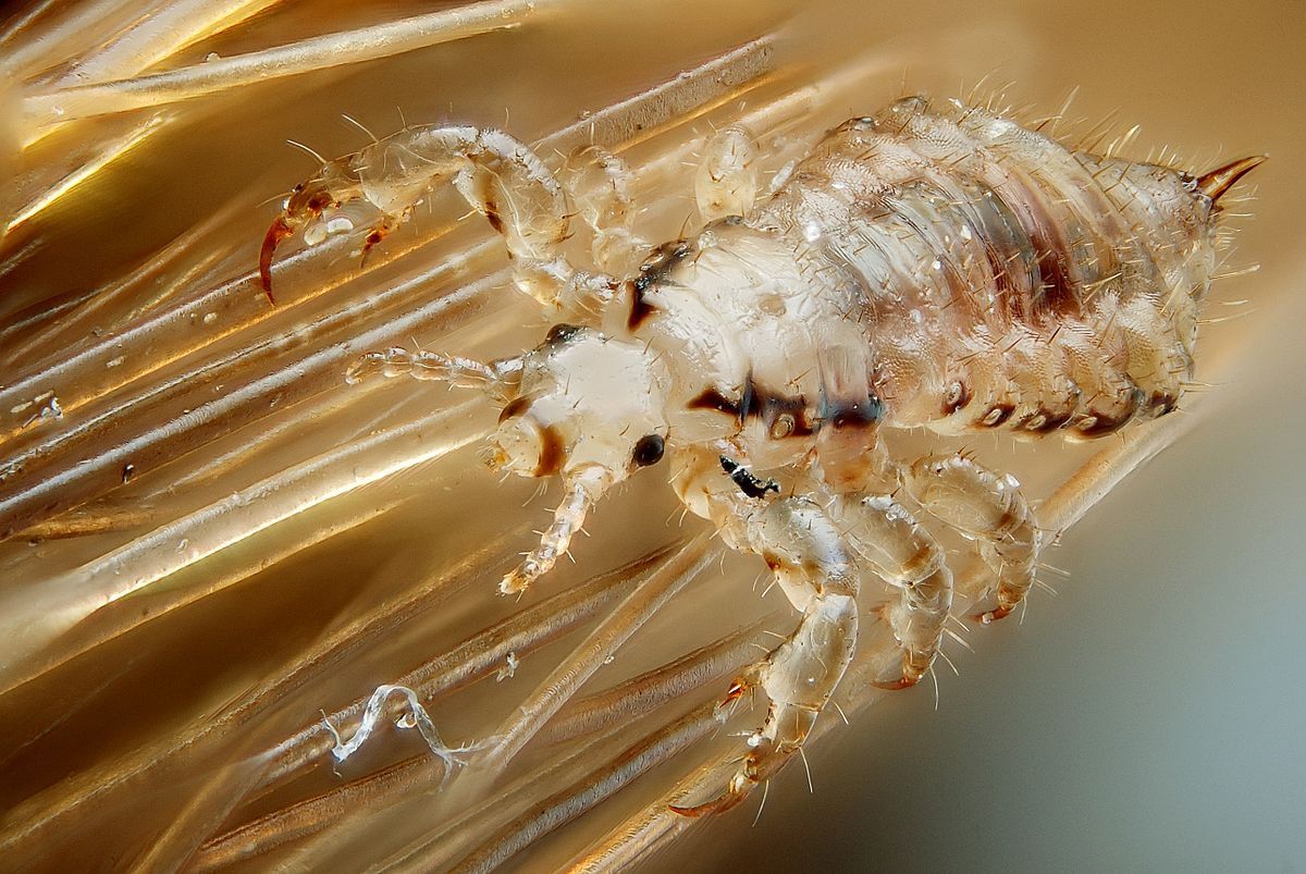 1200px-male_human_head_louse.jpg